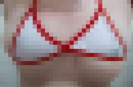 曬傷好痛 🥹__0